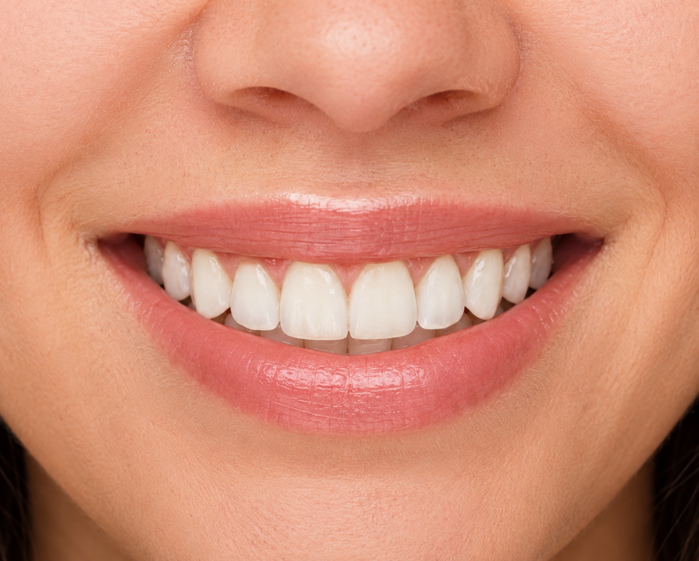 Case — dental aesthetics